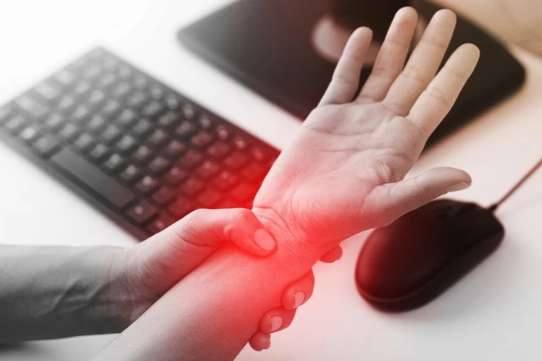 Carpal Tunnel Syndrome